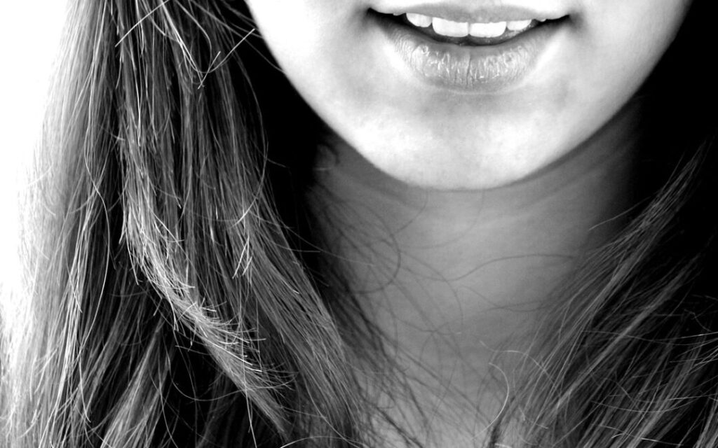 tinciones dentales