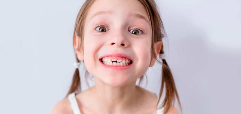 traumatismos dientes de leche